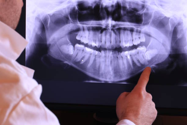 Best 24-Hour Emergency Dentist in Walnut Creek, CA