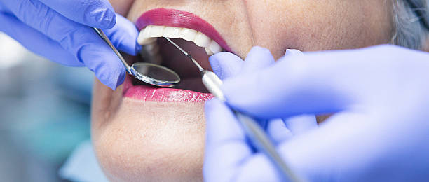 Best Pediatric Emergency Dentist in Walnut Creek, CA